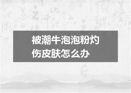 被潮牛泡泡粉灼伤皮肤怎么办