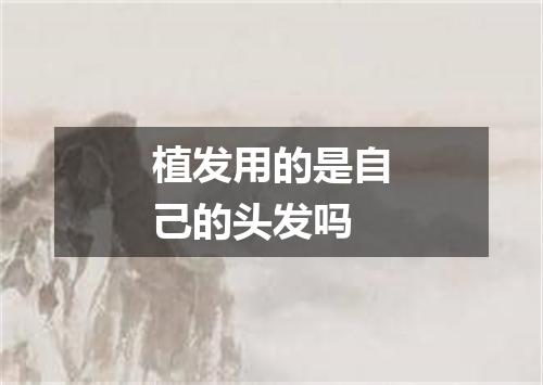 植发用的是自己的头发吗