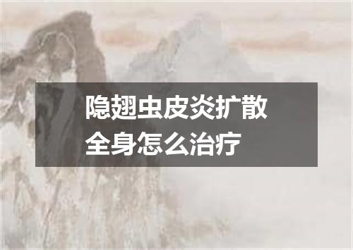隐翅虫皮炎扩散全身怎么治疗
